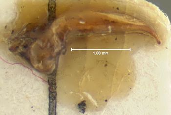 Media type: image;   Entomology 32990 Aspect: genitalia